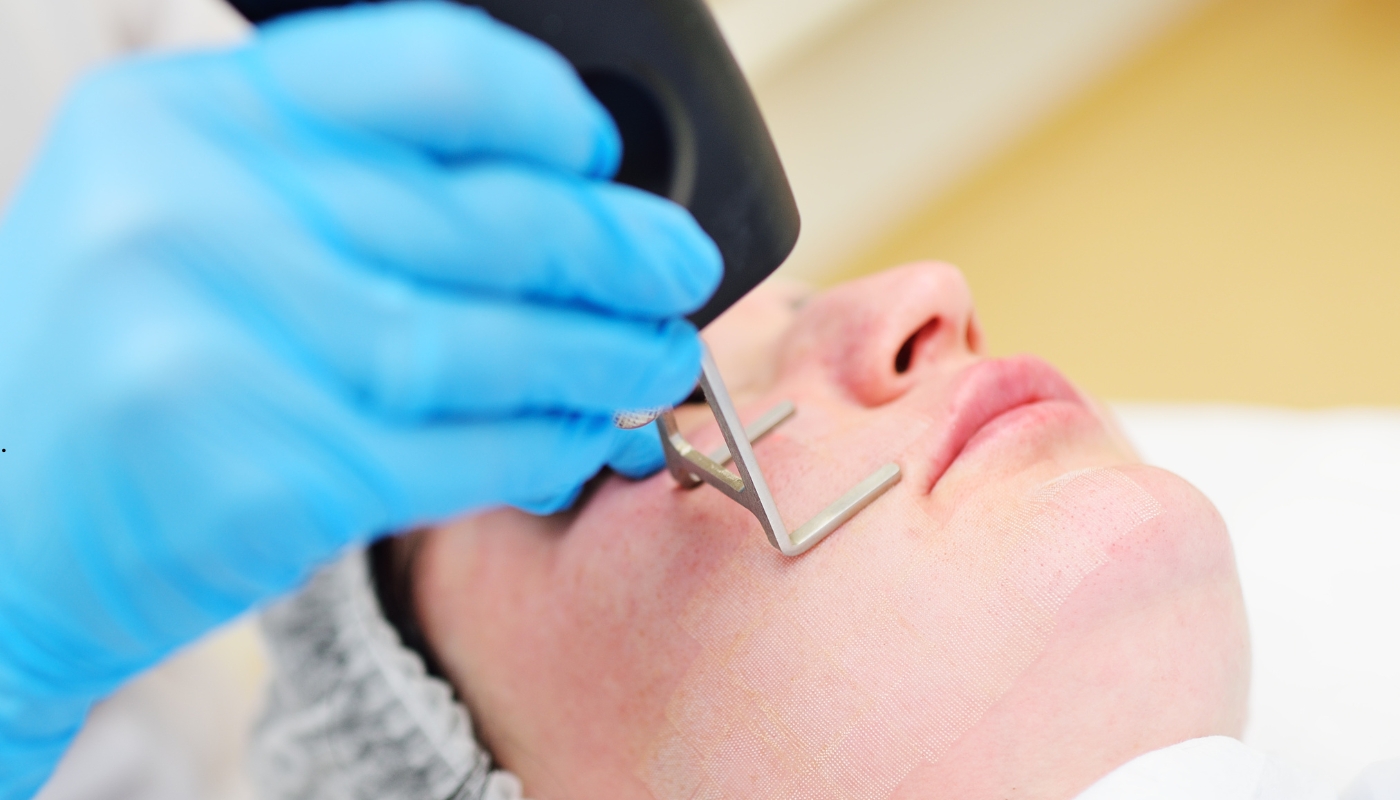 امرأة تخضع لجلسة علاج الندبات القديمة بتقنية الليزر في عيادات شيفون بإشراف طبيبة تجميل مختصة