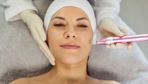 امرأة تتمتع ببشرة شابة ومشرقة بعد جلسة عناية بالبشرة في عيادات شيفون